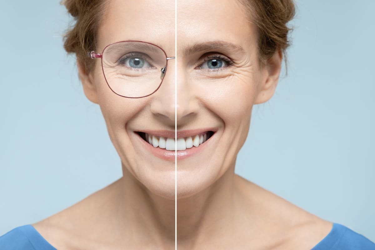 Femeie cu si fara ochelari de vedere, inainte si dupa chirurgie refractiva.